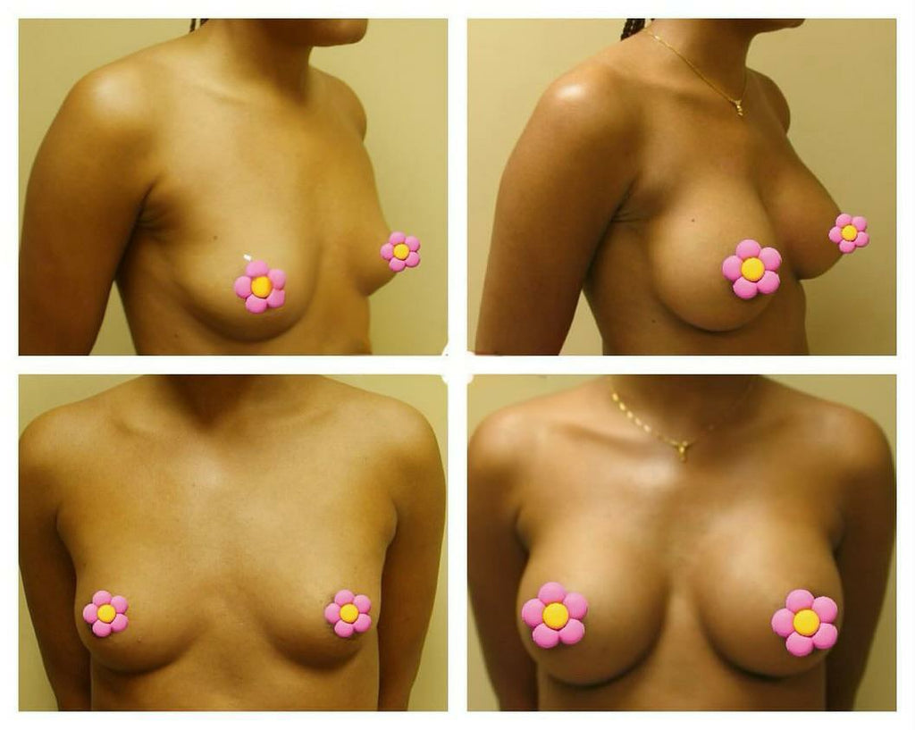 3in1 Breast Firming Pills